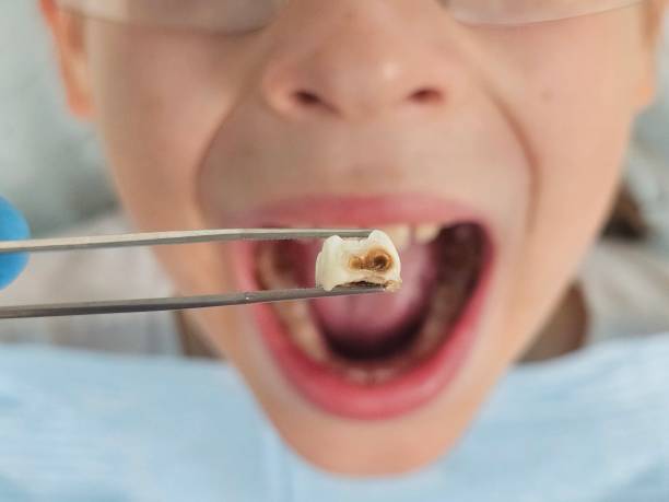Best Emergency TMJ Treatment in Creedmoor, NC